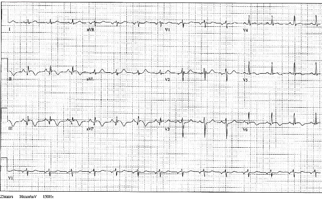 12lead ecg image 2