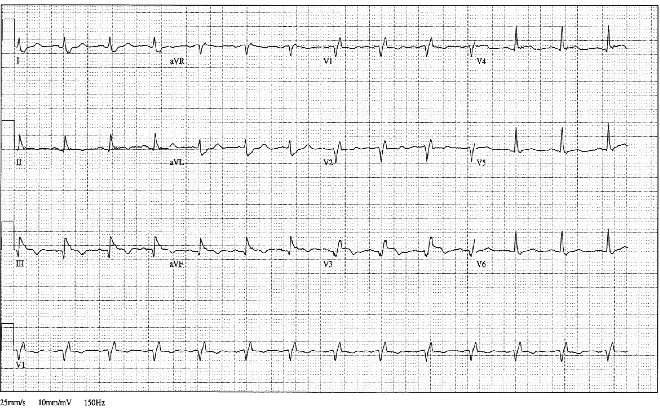 12lead ecg image 3