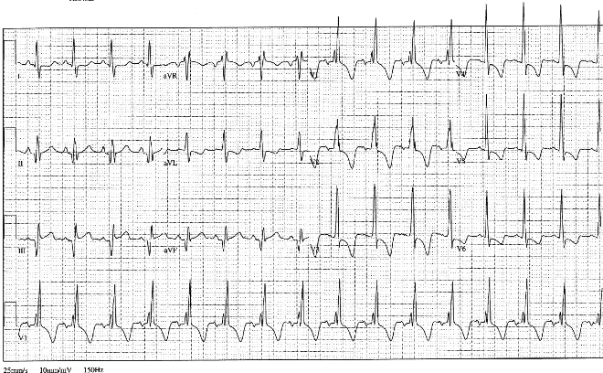 12lead ecg image 4