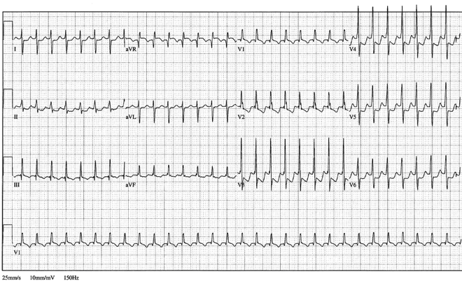 12lead ecg image 5