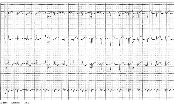 12lead ecg image 6