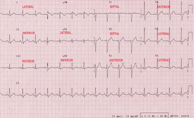 12lead ecg image 1