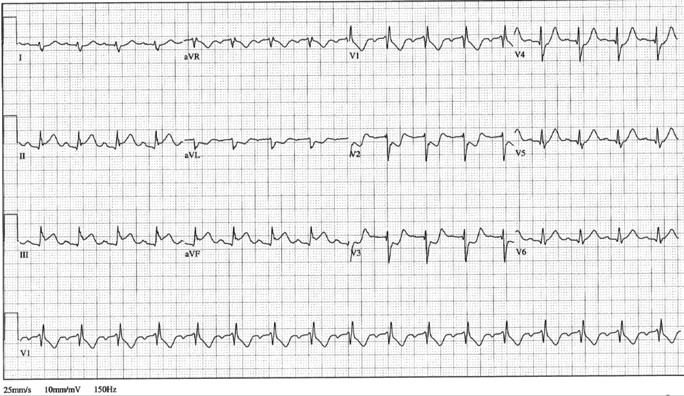 12lead ecg image 18