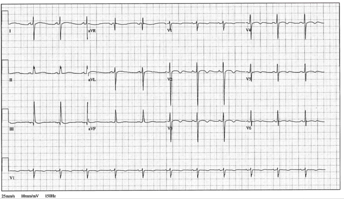 12lead ecg image 19