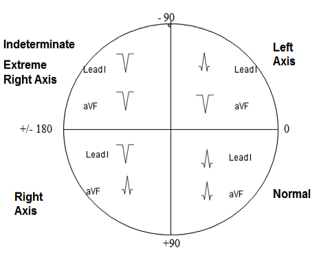 ECG Axis Determination EKG Interpretation | EKG.Academy