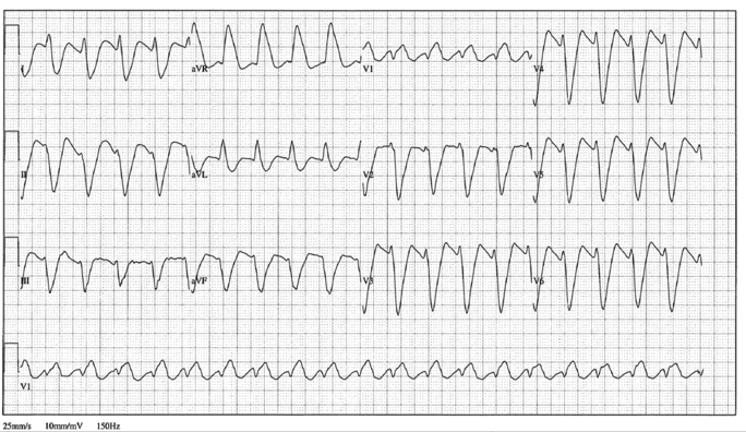 12lead ecg image 20