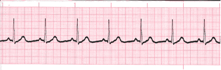 analysis ecg image 104