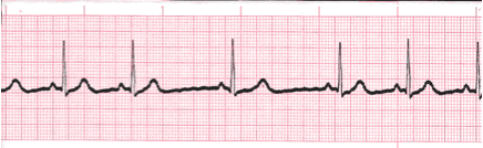 analysis ecg image 105