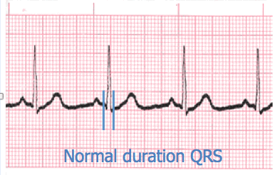 analysis ecg image 117