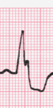 analysis ecg image 118