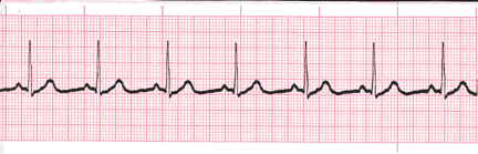 analysis ecg image 119