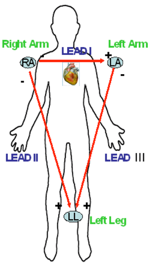 Einthoven Triangle - EKG Lesson #324