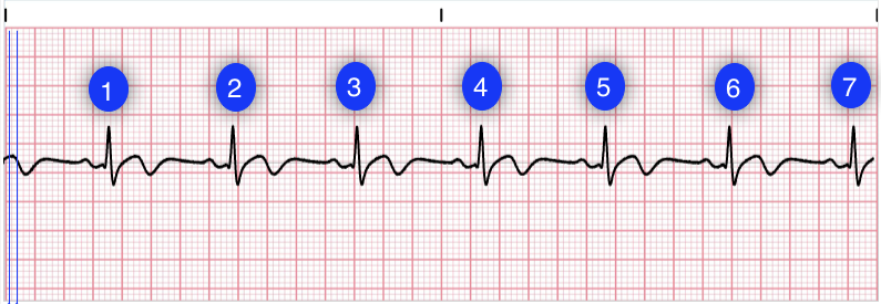 ECG nomenclature diagram