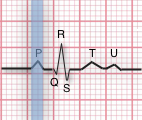 ekg nomenclature diagram