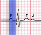 ekg nomenclature diagram