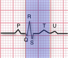 ekg QT Interval