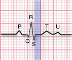 ekg nomenclature diagram