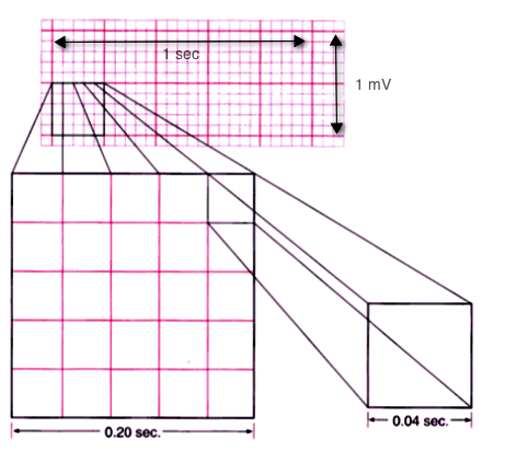 ekg tracing paper