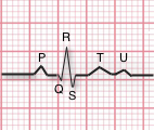 ekg nomenclature diagram