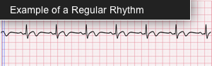 ekg regular