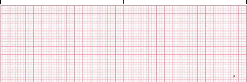 ekg rhythm strip for reference guide