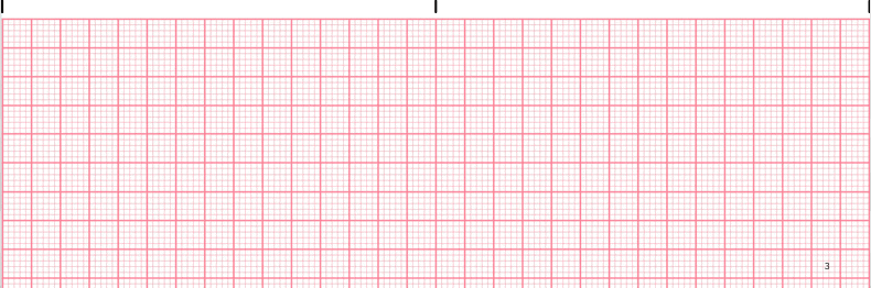 Ventricular Tachycardia ECG tracing