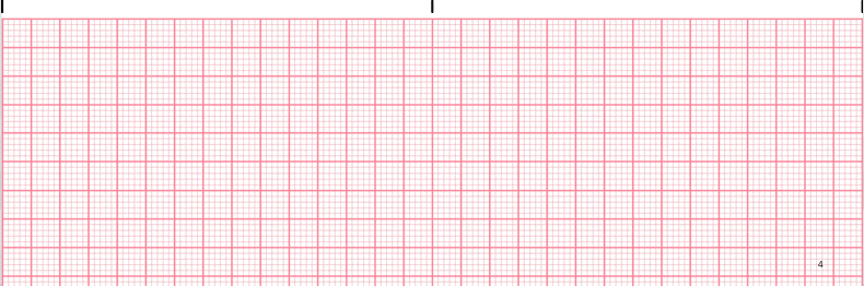 First Degree Heart Block EKG tracing