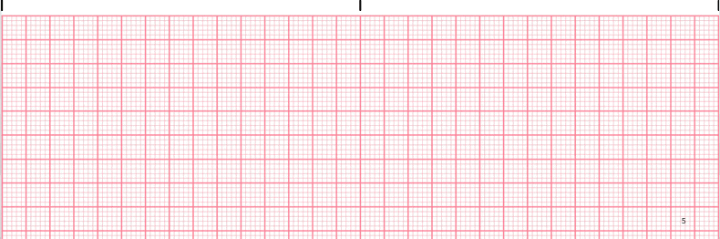 ecg rhythm strip for quiz