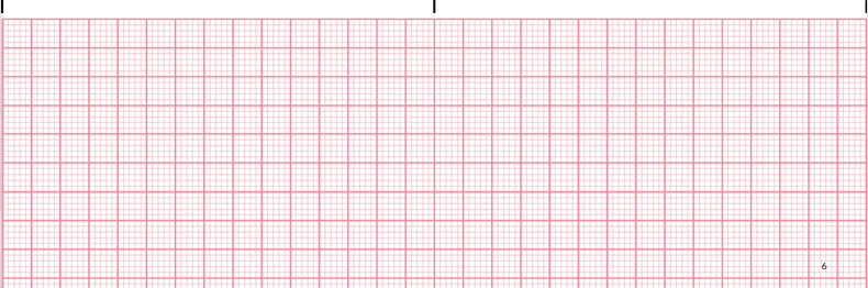 ecg rhythm strip for quiz