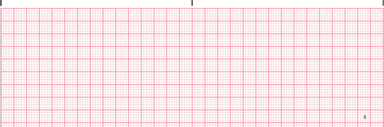 ecg rhythm strip for quiz