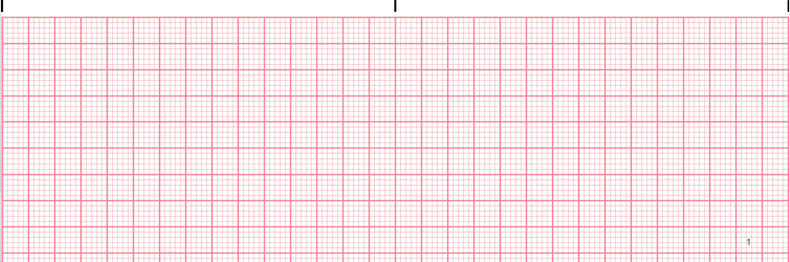 Premature Ventricular Complex EKG tracing