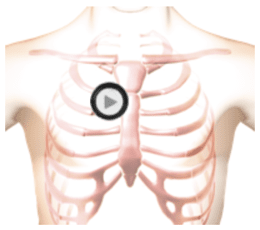 patient torso with stethoscope at Erb's Point position