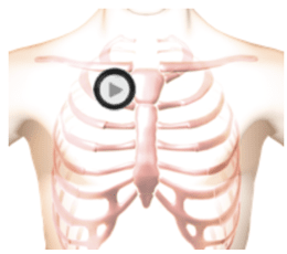 patient torso with stethoscope chestpiece