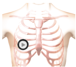 patient thorax when auscultating by stethoscope