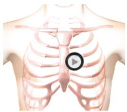 patient torso with stethoscope at Erb's Point position