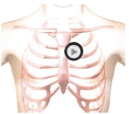 patient torso with stethoscope chestpiece