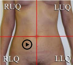 patient torso with stethoscope at Erb's Point position