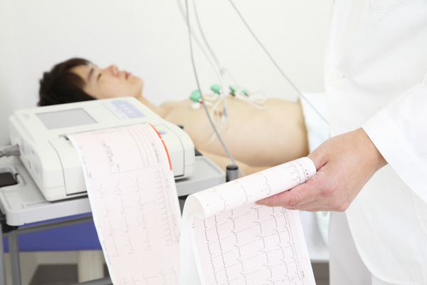 ekg tracing example illustration