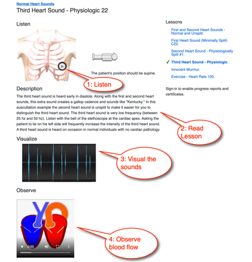 listening to heart sounds