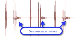 decrescendo murmur