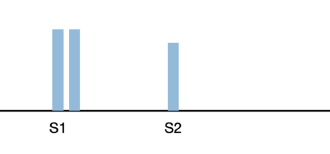 split s1 heart sounds diagram