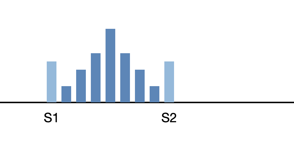 severe systolic murmur diagram