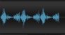 Acute Pericarditis waveform