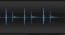 AorticRegurgitation (Decrescendo Diastolic Murmur) waveform