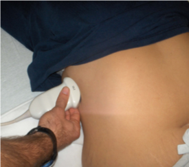 sensor position for thoracic fluid ultrasound