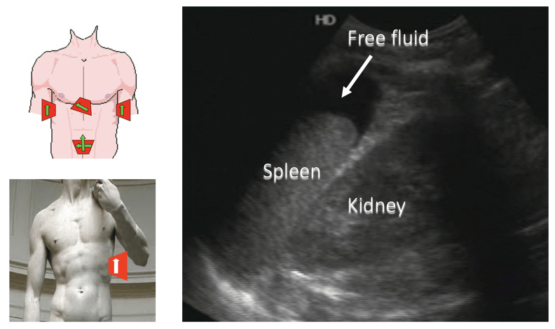 ultrasound annotated image