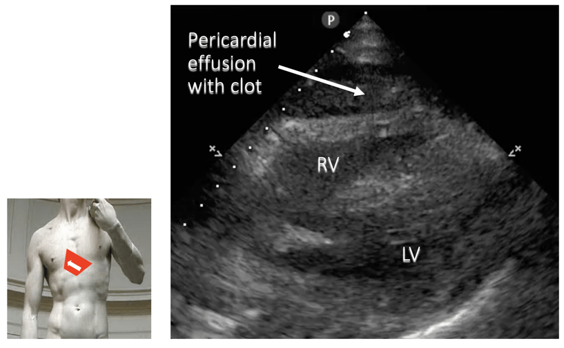 ultrasound annotated image
