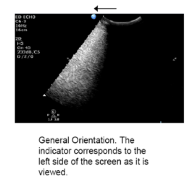 heart ultrasound image