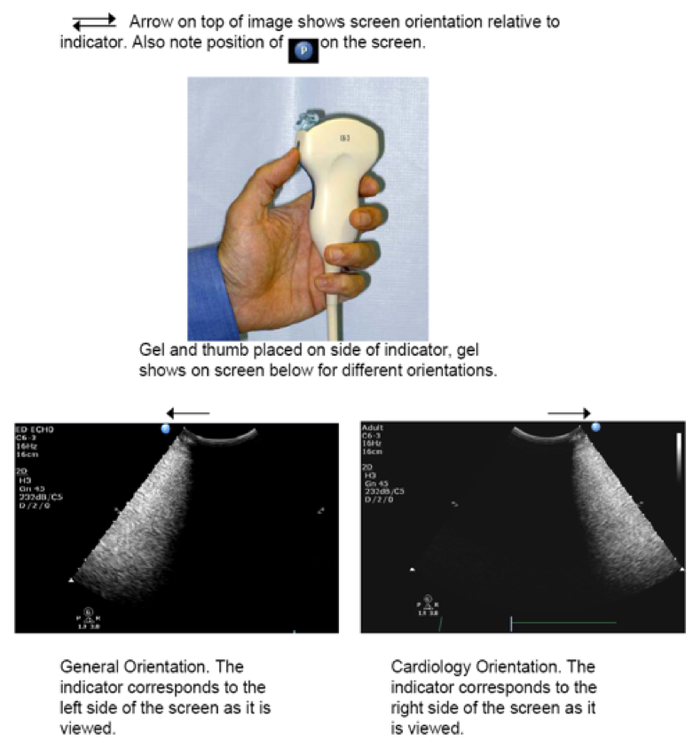 cardiac ultrasound image