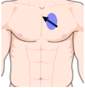 ultrasound sensor position